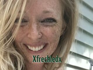 Xfreckledx